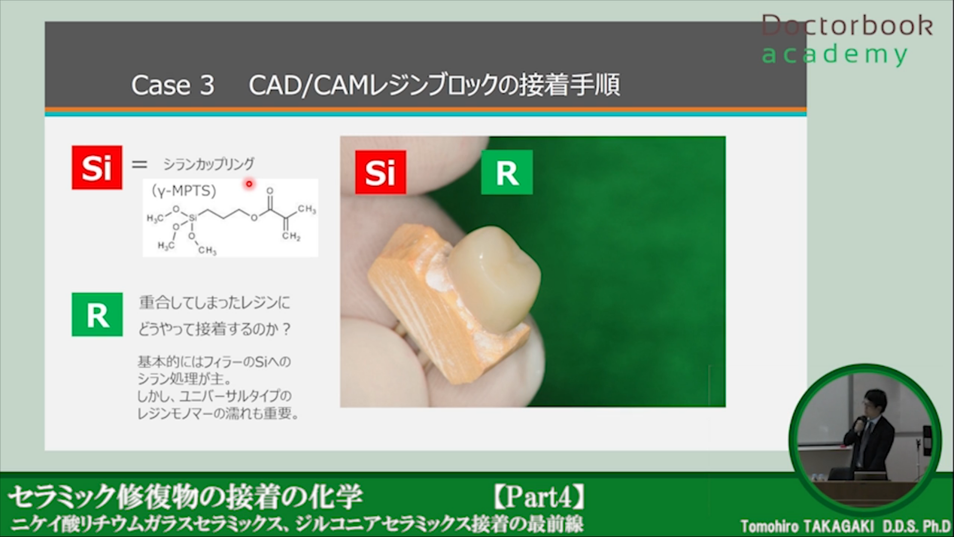 Special】セラミック修復物の接着の化学 ~最前線に迫る